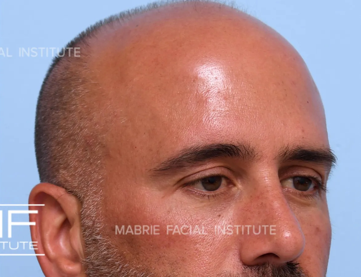 After Image