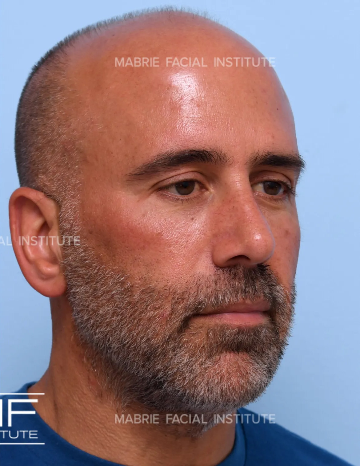 After Image