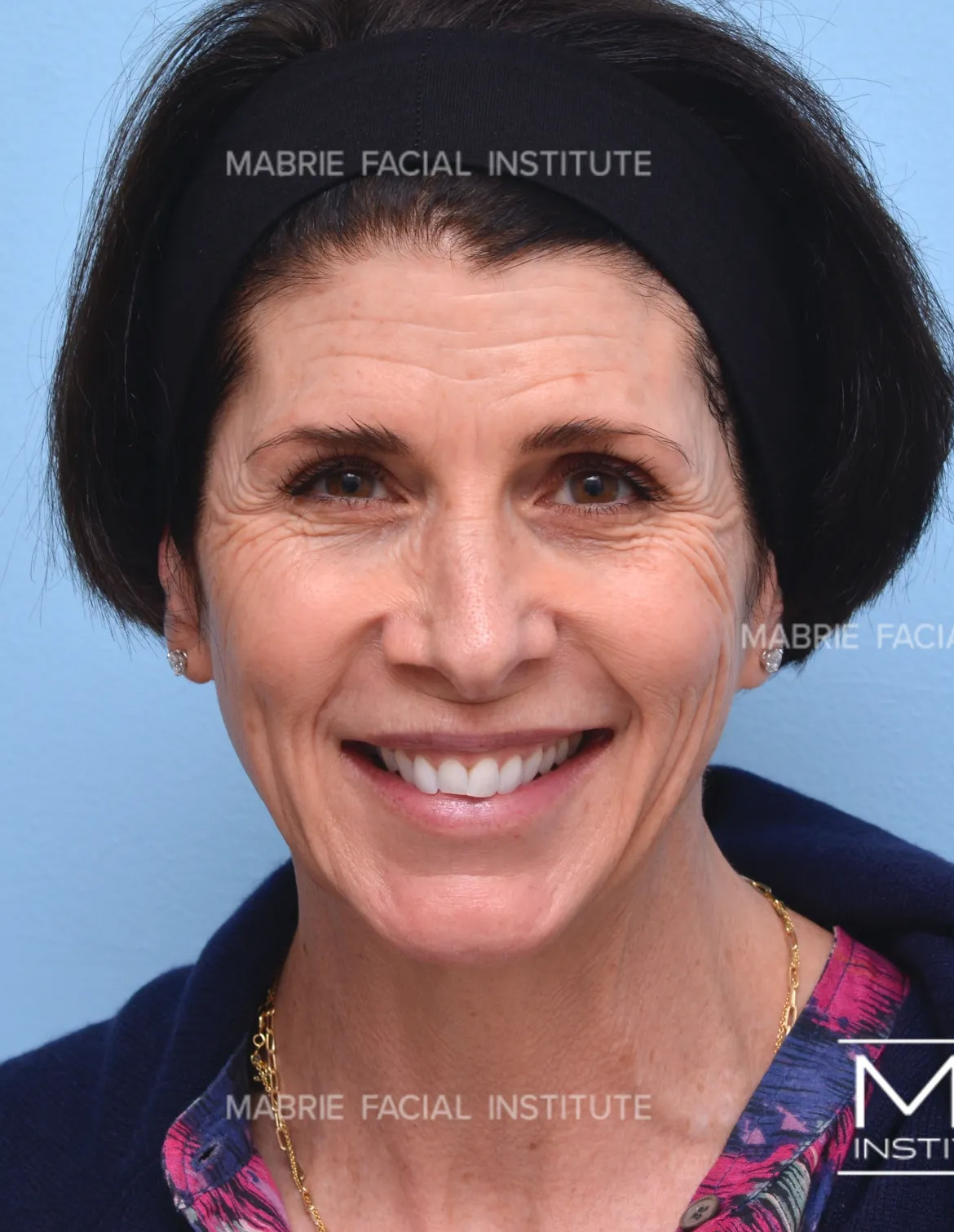 Before Image