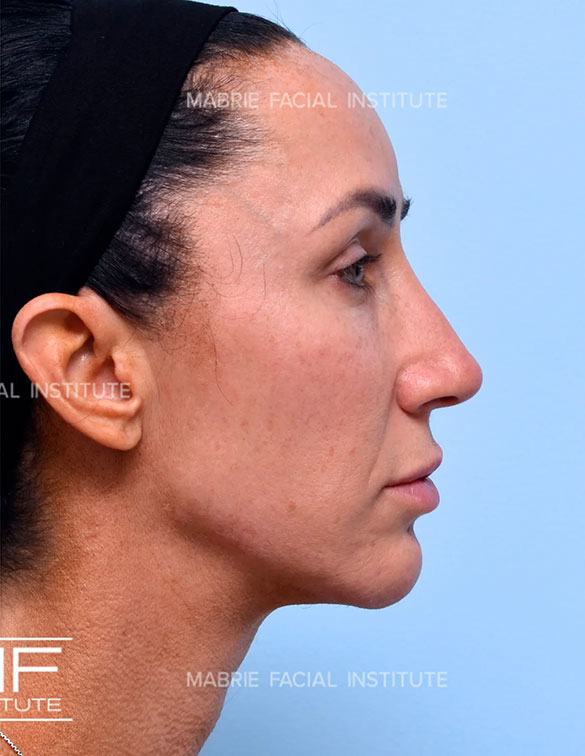 Illumination 360° Full Face after