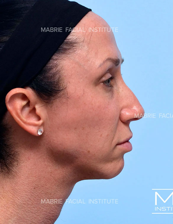 Illumination 360° Full Face before