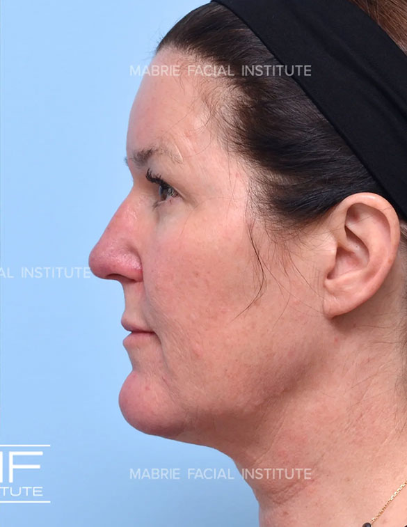 Illumination 360° Full Face after