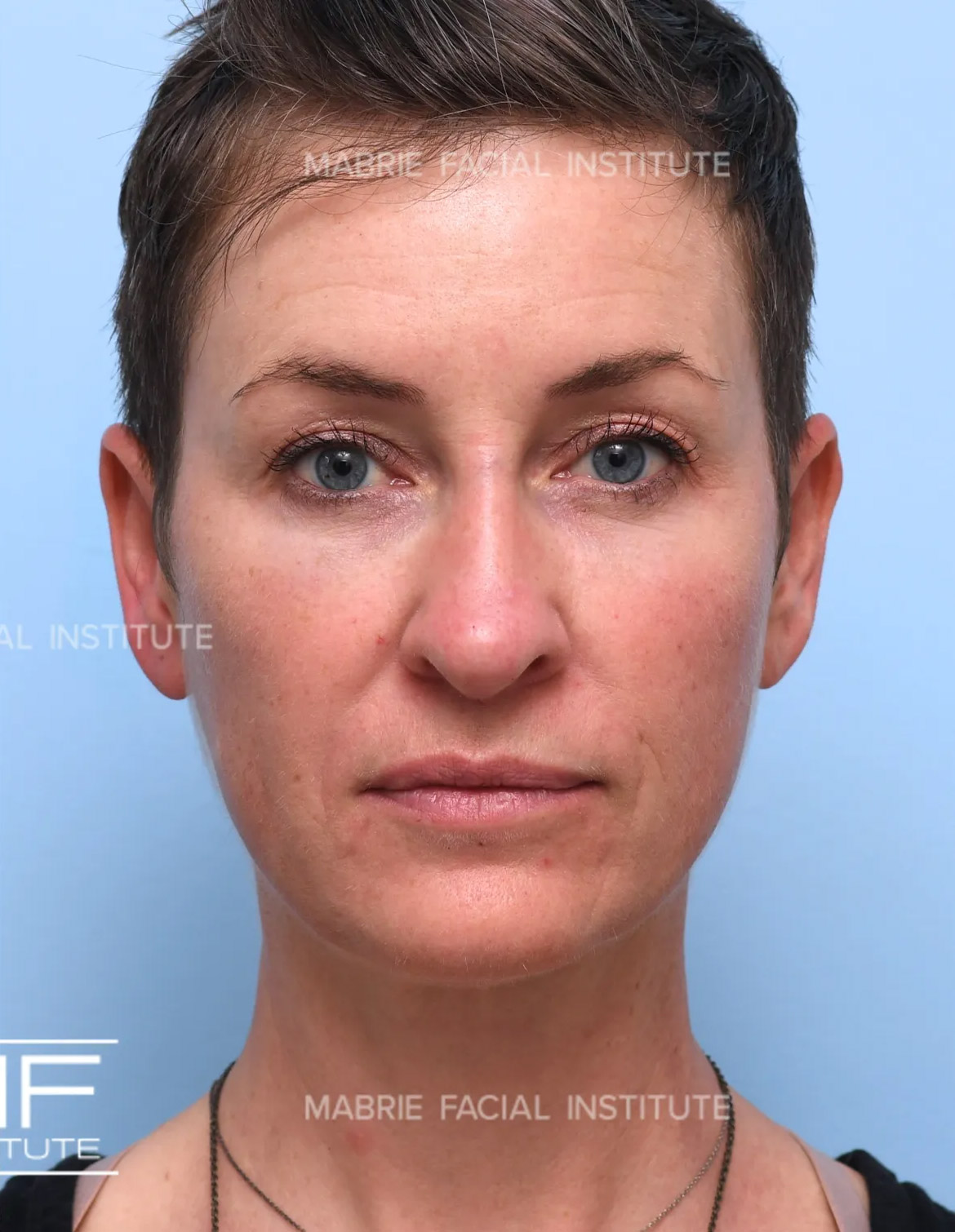 After Image