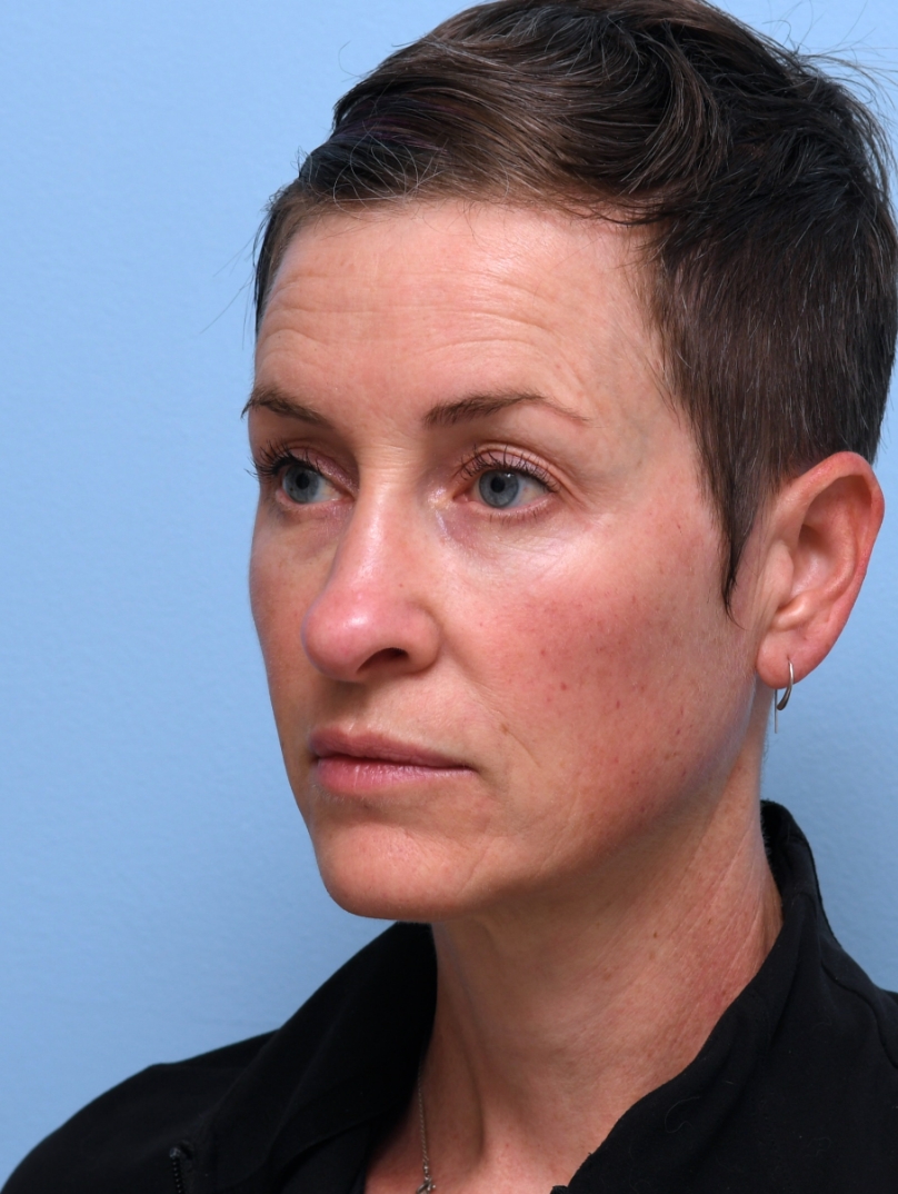 Over 1.5 Years Later: Still enjoying strong definition; time for a small touch-up.