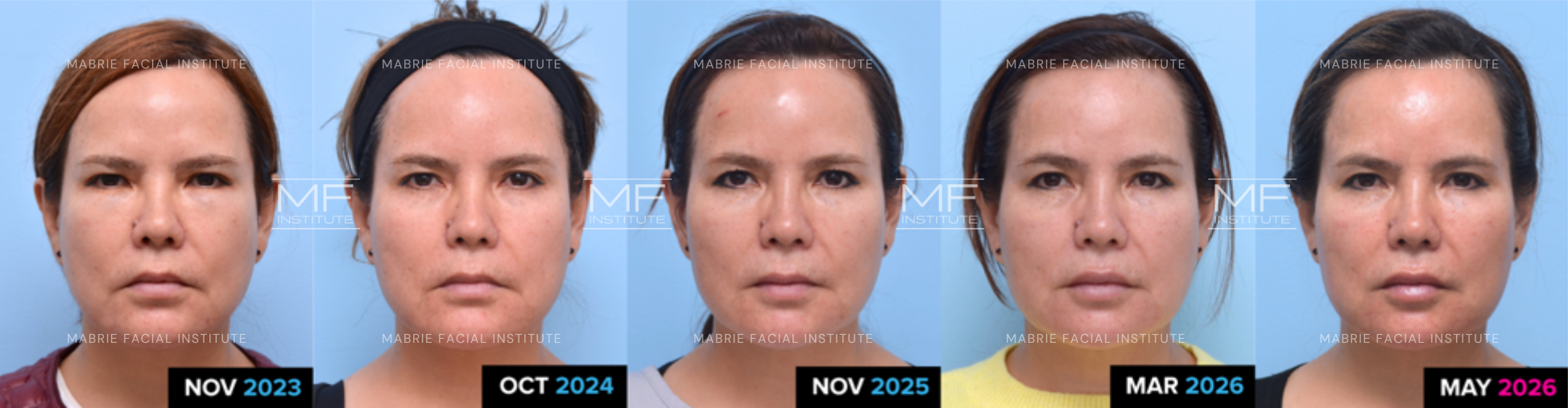 Before and after photos.