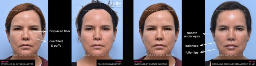 Before and after photos.
