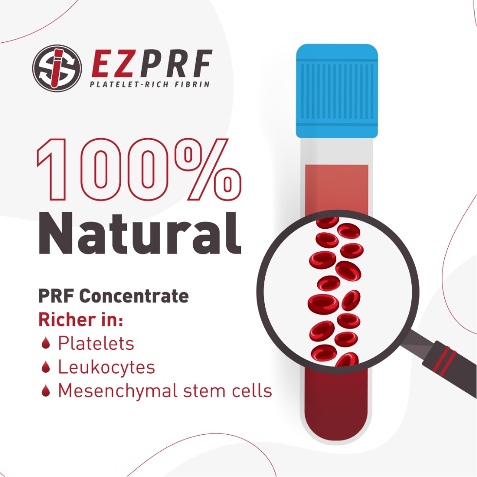Graphic for EZPRF Platelet-Rich Fibrin reading “100% Natural,” with a test tube, magnifying glass, and text noting PRF concentrate is richer in platelets, leukocytes, and mesenchymal stem cells.