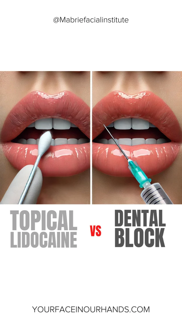 Dental Block vs. Numbing Cream – Which One Wins? 🤔💉

How many ways can you numb your lips before filler? 😜💋 We put dental block and numbing cream to the test!

Had fillers? Which one worked best for you? 

S
T
A
Y

B
E
A
U
T
I
F
U
L

#lipfiller #lipnumbing #plumplimps #topicallidocaine #dentalblock #mabriefacialinstitute #sanfrancisco