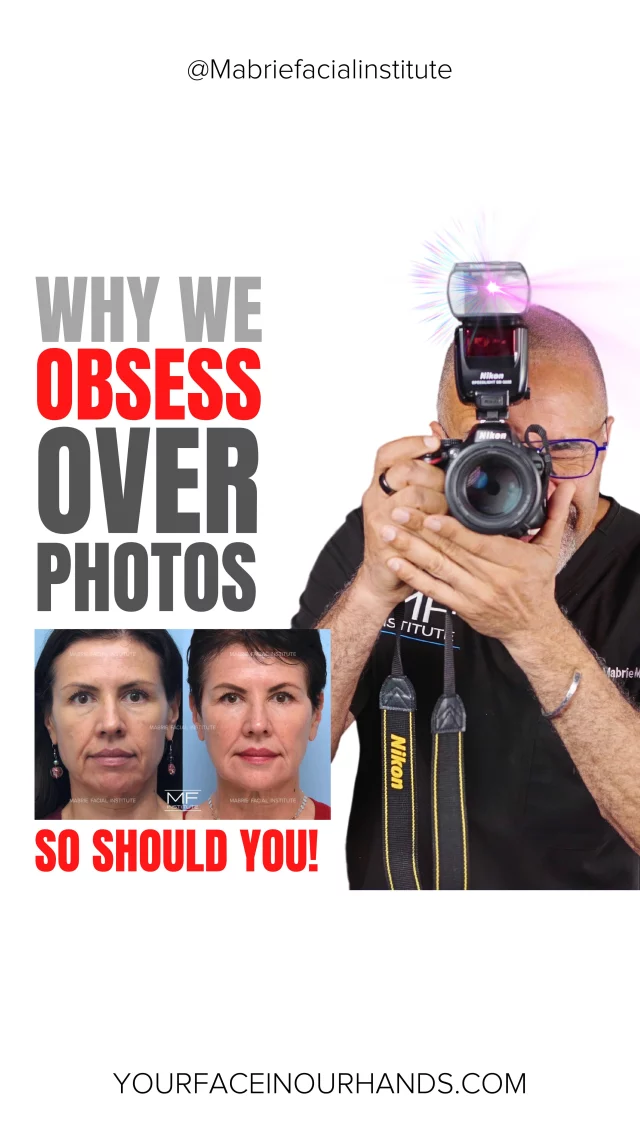 Creating consistent before-and-after photos takes time, precision—and yes, a little obsession!

From lighting and angles to clothing and camera distance, every detail matters.💜

Why? Because we want you to see the real progress of your filler journey—without filters, tricks, or guesswork.

🎥 Watch the full video to see how we capture results (and why it matters).

S
T
A
Y

B
E
A
U
T
I
F
U
L

#beforeandafters #surgicalresults #nonsurgicalresults #fillersandbotox #undereyefiller #jawlinefiller #lipfiller #nonsurgicaltreatments #sanfrancisco