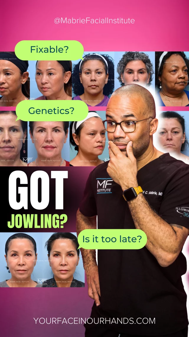 Jowling doesn’t always mean facelift. 💉
For this patient, we used our Illumination 360° approach—strategic filler placement to restore lost volume, sharpen the jawline and a little more...
The result? A more sculpted face—without surgery.

💬 Noticing early jowls? You’re not alone.
👉 Follow @MabrieFacialInstitute to see how Illumination 360° brings everything together.

Tag someone who needs to see this! 😘

S
T
A
Y

B
E
A
U
T
I
F
U
L

#undereyefiller #dermalfillers #fillers #darkcircles #jawlinecontouring #contourandhighlight #undereyefiller