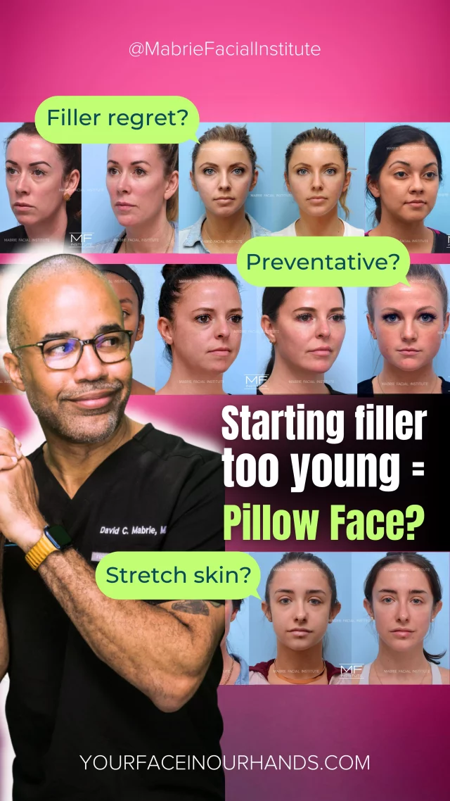 🚨 Starting filler too young = pillow face? 🚨
8 years. 8 treatments. A woman in her 20s.

👉 The internet says “you’ll ruin your face.”
👉 The truth? It depends on WHO does it, HOW it’s done, and whether there’s a full-face plan… not just chasing lips and cheeks.

This case shows that early filler when done right doesn’t mean “pillow face” later. 

👉 Follow us for more #FullFaceFillerFridays / where we can proof that long-term filler results can look balanced and natural.

💬 Be honest: do you think starting filler in your 20s is genius … or too soon?

Tag someone to share that with! 😘

S
T
A
Y

B
E
A
U
T
I
F
U
L

#dermalfiller #jawlinecontour #chinfiller #undereyefiller #facialbalancing #undereyecircles #pillowface #undereyebags #sanfransisco