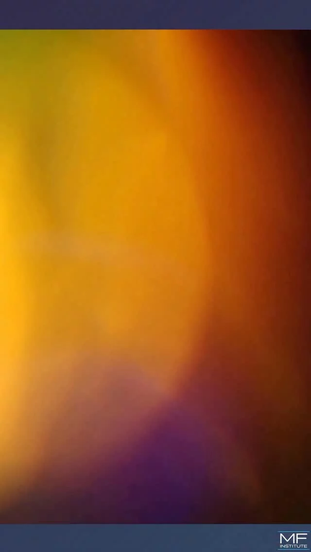 🫩Heavy Brows Weighing You Down?  i360 Full Face with BOTOX & Injectables are a real eye opener!😃
 
In 3 treatments over 4 months our signature i360 Full Face treatment helped this patient reshape and refresh her look non surgically.  It’s facial rejuvenation and contouring with intention, not “just filler”.
 
These results are possible when strategic changes work together – your features look balanced, lifted, and unmistakably you.
 
If you’re curious about full face treatment, under eye rejuvenation, or a non-surgical facelift that actually look natural…

👉🏾DM @mabriefacialinstitute to schedule your personal consultation.

S
T
A
Y

B
E
A
U
T
I
F
U
L

#aestheticmedicine #filler #lipfiller contouring beautyhacks antiaging contour hyaluronic hydrating wrinkle i360FullFace SanFrancisco