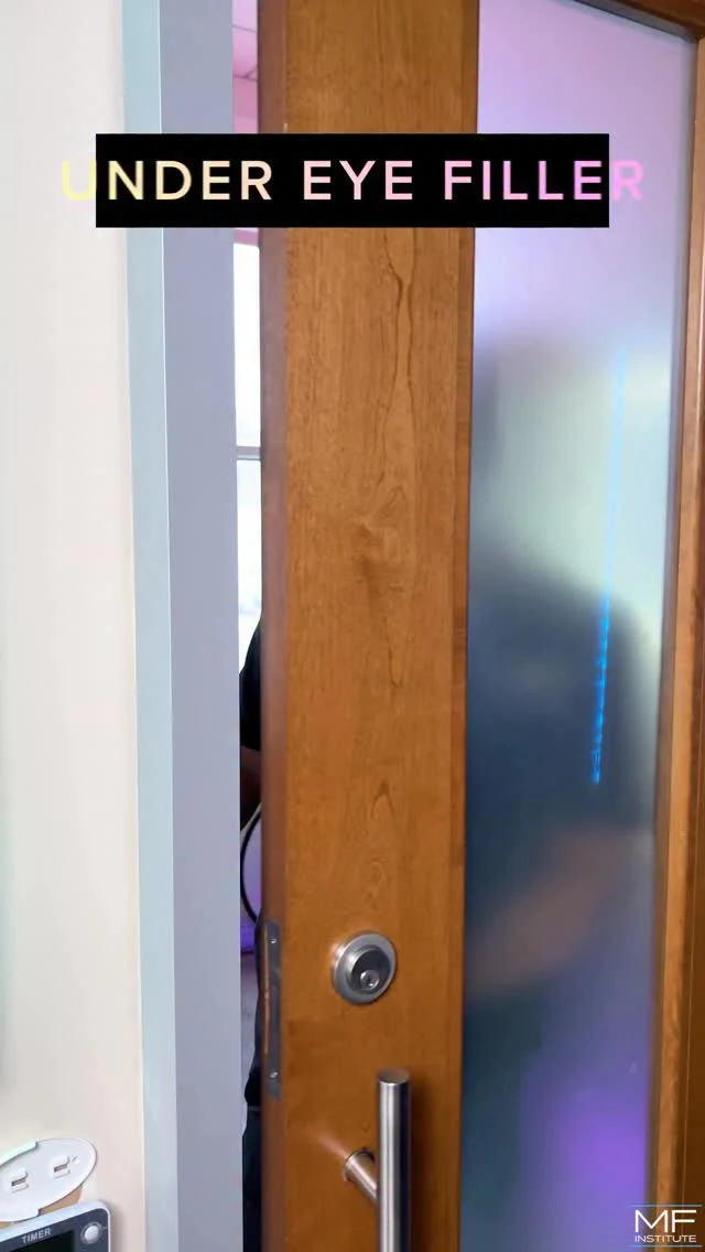 Think under eye filler doesn’t work?
Take another look 👀

When it’s done correctly, hyaluronic acid filler can soften dark circles, smooth under eye bags, and restore the support that’s been lost over time.

If you’ve seen under eye filler that looks puffy or obvious…
that’s not “filler gone wrong.”
👉🏾That’s technique and placement.

The under eye is one of the most technically challenging areas we treat and technique really does matter. 

The key is choosing someone who understands anatomy and knows how to place the right filler, in the right location, in the right amount.

Follow along if you want to see how under eye filler should actually look: subtle, intentional, and in harmony with your face. 💜

#undereyefiller #undereyecircles #undereyebags #i360FullFace