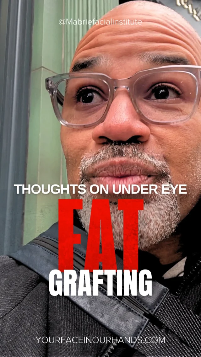 Under eye fat grafting… would you do it again?

Dr. Mabrie is a facial plastic surgeon who performed surgery for years and now focuses exclusively on injectables. In this video he shares his perspective on fat grafting under the eyes.

Have you had it done?
Would you do it again?

If you’ve had under eye fat grafting 
👇 would you do it again?

Share your experience for all the people here who are curious and have questions about it.

📍Facial Plastic Surgeon & Injector
San Francisco

#fatgrafting #fillers #undereyefiller #FacialBalancing #antiaging
