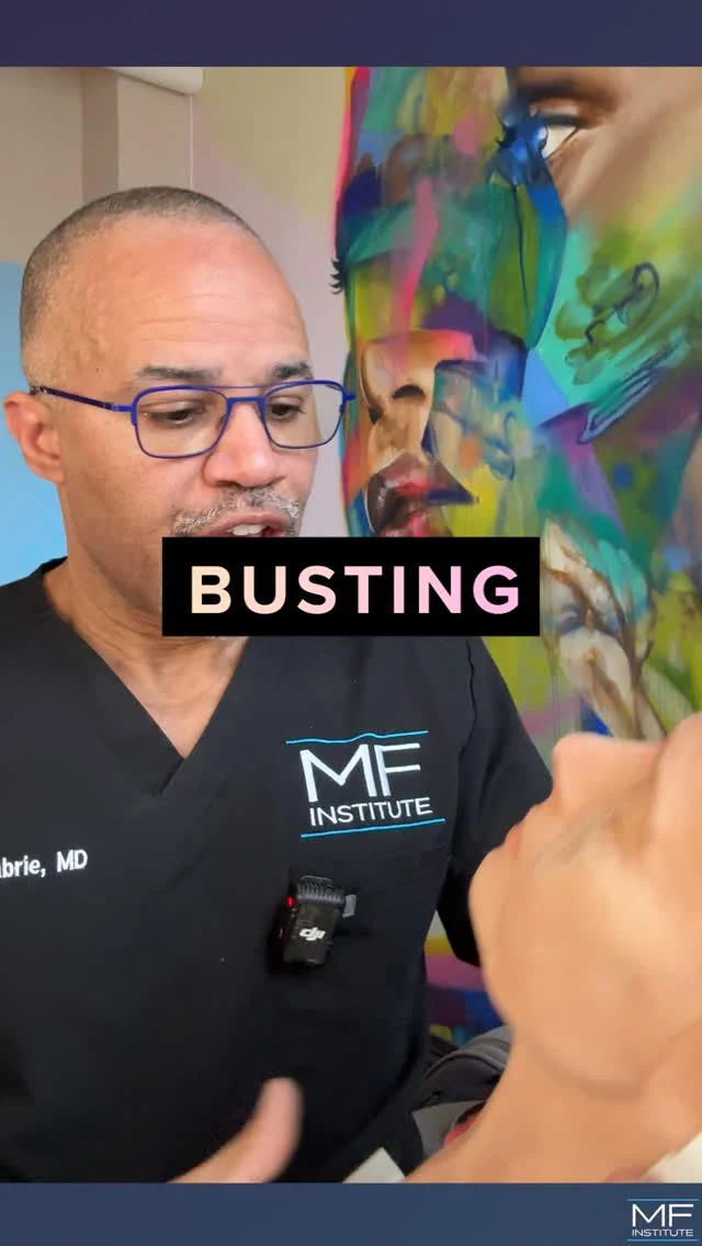 Worried treating your midface and dark circles will make you look "too cheeky"?
That's one of the biggest misconceptions we hear.

Dark circles don't live in isolation.
To treat them correctly, you often have to address the entire aesthetic region (the midface, cheekbones, and tear troughs).

Supporting the midface doesn't mean exaggerated cheeks.
It means subtle contour and a result that still looks like you.

This is the difference between spot-treating a problem and understanding the face as a whole.

Natural doesn't mean doing less.
It means doing it right.

💜 Follow for anything injectables and why full face planning changes everything.

#undereyefiller #undereyecircles #nonsurgical #nonsurgicalfacelift #FacialBalancing