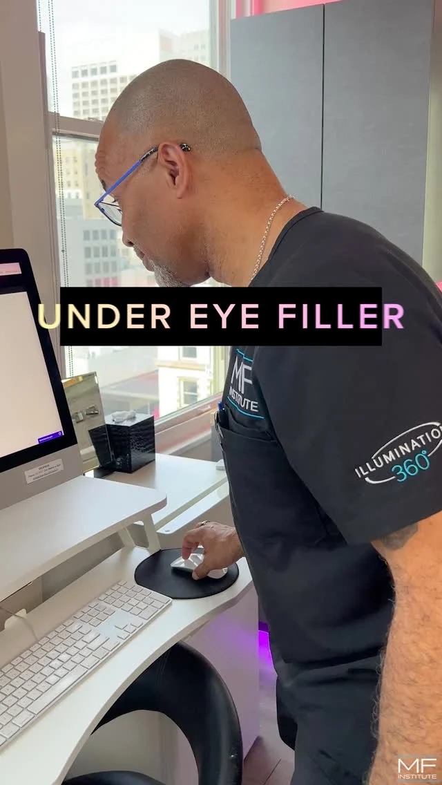 Think under eye filler won't work?
Think again👀

When placed correctly, hyaluronic acid filler can soften dark circles, reduce under eye bags, and restore lost support.

If you've seen under eye filler that looks puffly, swollen, or obvious...
that's not "bad filler."

That's poor placement.

Under eye rejuvenation isn't just about adding volume. It's about restoring structure so light reflects the way it used to.

💜 Follow along to learn how under eye filler should look... subtle, intentional, and harmony with your face.

#undereyefiller #undereyecircles #undereyebags #teartroughfillers