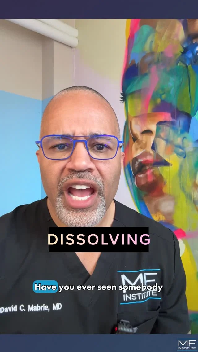 That blue-gray, puffy under eye look isn't random.

If you'e noticed under eye filler that looks worse in the morning and settles as the day goes on, there's ususally a reason. You may be experiencing the Tyndall Effect.

When filler sits too close to the surface, it can pool and reflect light in a way that looks blue or gray, especially under thin under eye skin. That doesn't mean filler shouldn't be used there. It means it has to be placed in the right location.

Here we dissolved filler by another provider for a reset.

Here's the part most people don't hear:
If you see a bad filler result, it doesn't mean filler doesn't work.
👉🏾 It means the technique wasn't right.

Placement changes everything. Precision over volume. Always.

#undereyefiller #undereyebags #nonsurgical #FacialBalancing