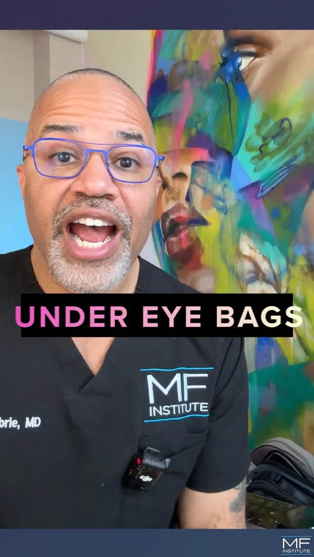 Can filler fix under eye bags?
Short answer: yes!
Real answer: Only if you know where NOT to put it.

Treating under eye bags requires more than product, it requires a plan.
By restoring structure through the midface, cheekbone, and tear trough, we're able to soften the appearance of bags without overfilling or distorting the area.

It's not about just adding volume. It's about designing support.
When done correctly, the entire under eye area looks smooth, lighter, and more supported.

That's the difference between looking "done" and smilply looking refreshed.

💜 Comment „Eyes“ and we’ll share our approach on treading the under eyes with fillers.