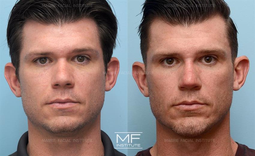 Take a look at his 2021 Before and After treatment results! 